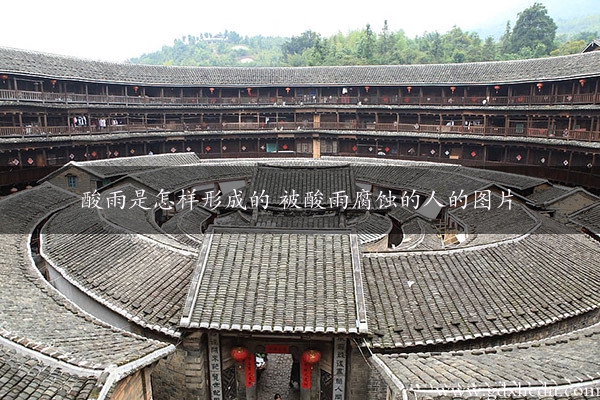 酸雨是怎样形成的 被酸雨腐蚀的人的图片