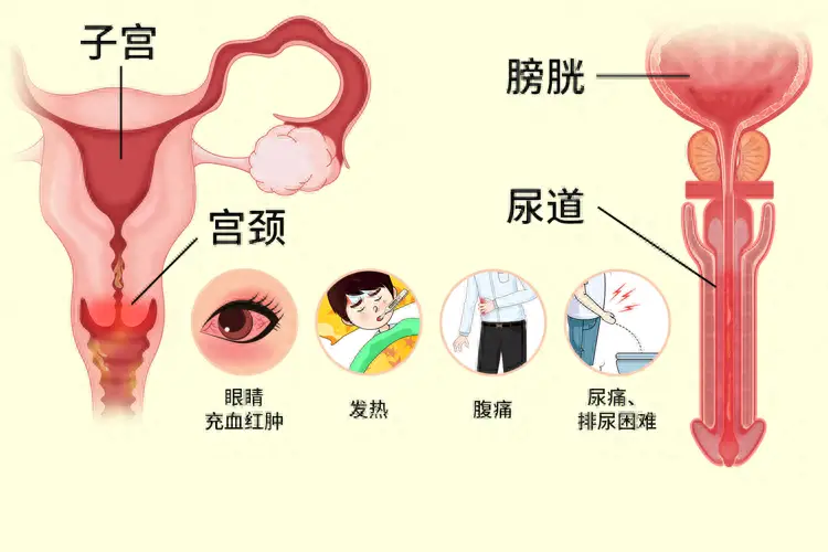 性生活前如何判断对方是否患有性病？了解6类常见性病的症状表现  第2张