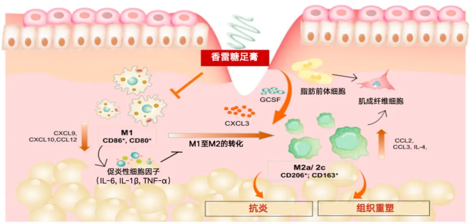 糖尿病足溃疡早期干预的重要性：预防截肢与改善预后  第1张