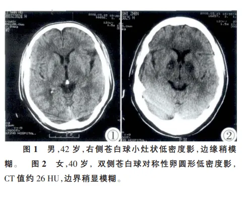 微信推送规则改版，星标公众号防走丢，甘蔗霉变中毒风险解析  第2张