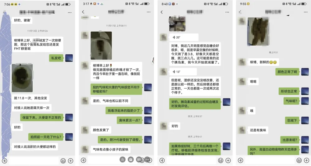 45岁2型糖尿病患者通过肠道菌群移植改善血糖控制，无需肠镜检查