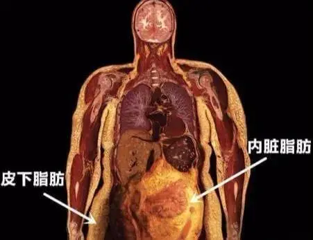 揭秘男女肥胖差异：为何男性胖肚子，女性胖臀部和大腿？  第2张