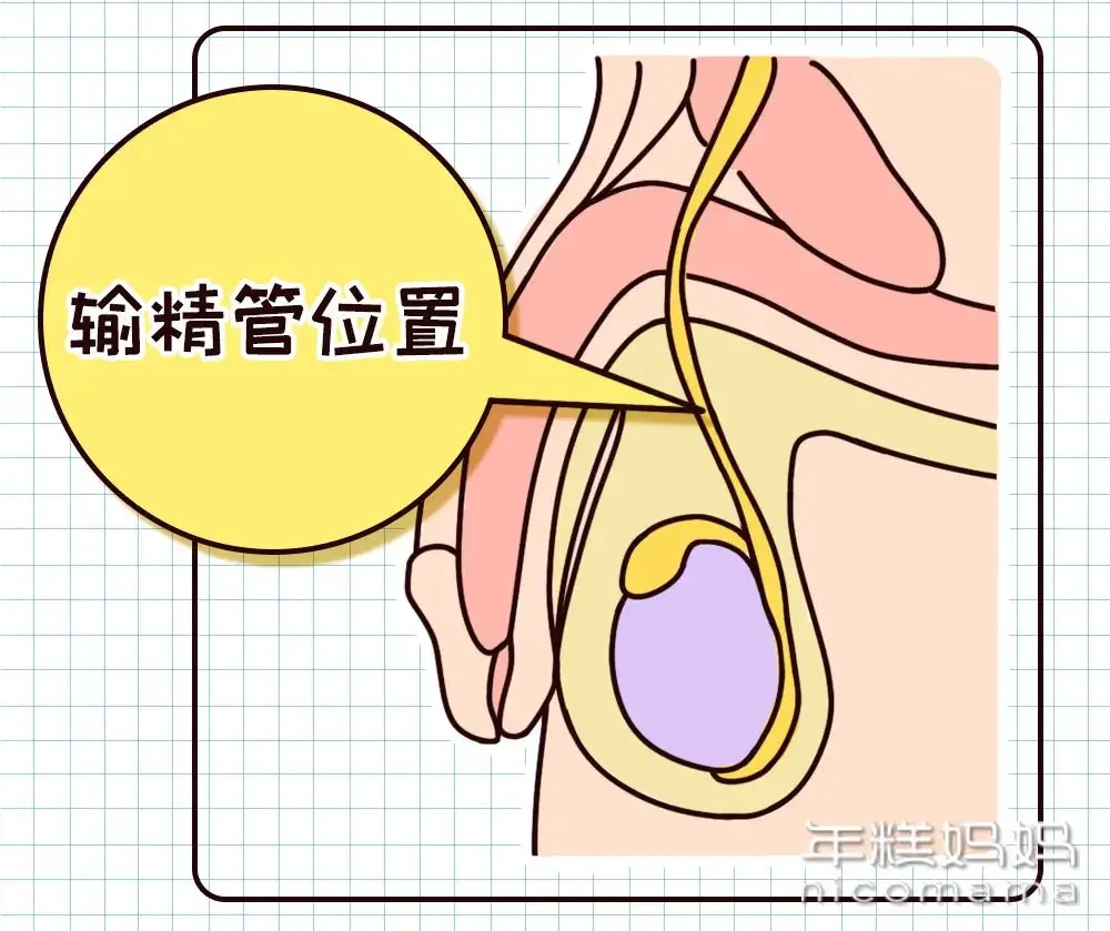 男性避孕方式科普：揭秘男性在避孕中的责任与选择  第2张