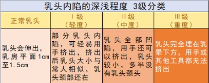 乳头内陷矫正手术详解：乳头整形手术种类及影响  第1张