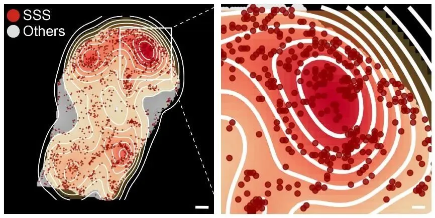 中国科学院动物研究所绘制全身器官衰老空间地图，揭示免疫球蛋白异常积累是衰老元凶  第2张