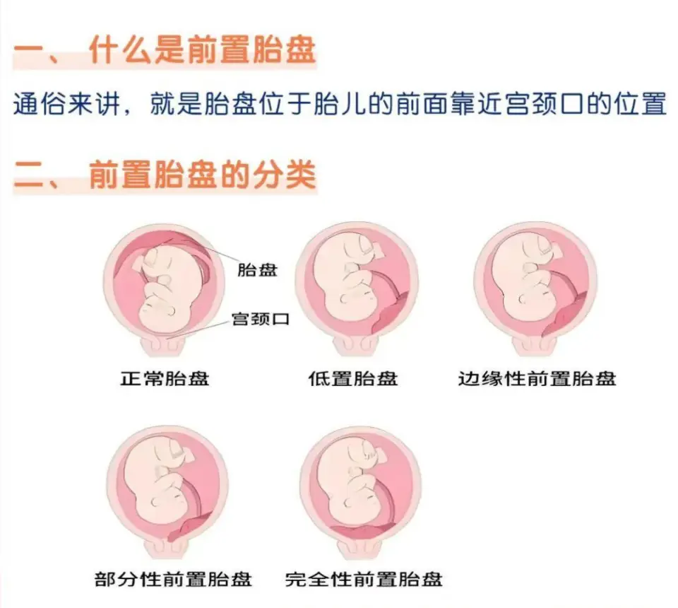 聊城市人民医院成功救治39岁高危产妇，生命保卫战温暖人心