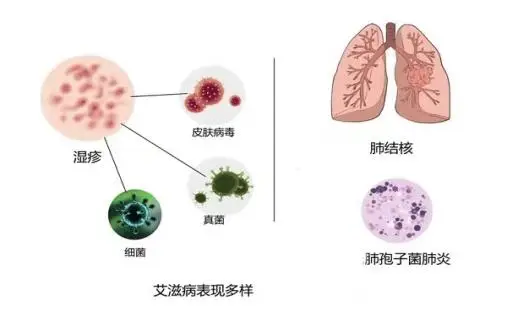 2024世界艾滋病日：社会共治终结艾滋，共享健康  第8张