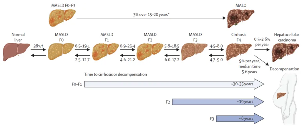 肥胖与2型糖尿病患病率攀升，MASLD成常见慢性肝病，柳叶刀阐述其肝损伤动态  第2张