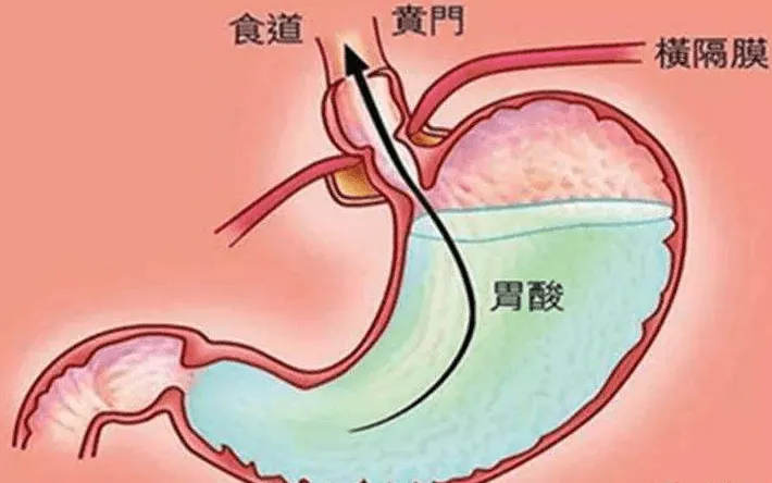 揭秘人体奥秘：胃液的产生与胃酸的形成机制及重要性