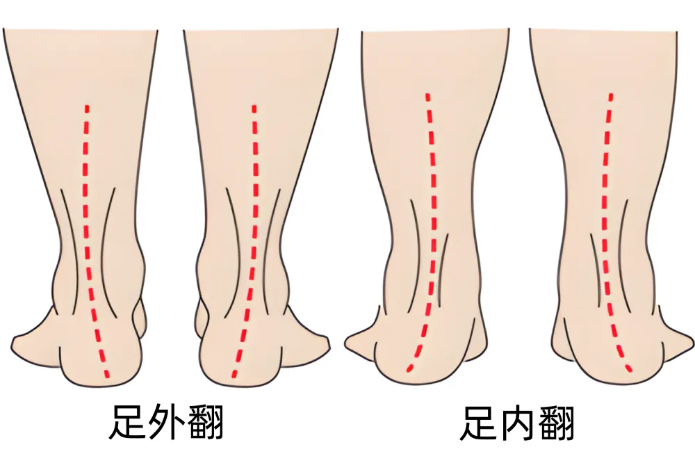 足部健康与脊柱运动链的紧密关系：如何通过足部运动改善全身协调性  第5张