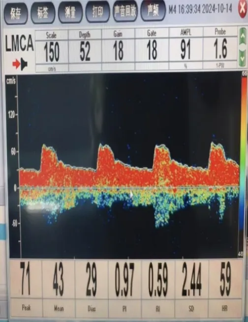 49岁岳阳刘先生因吸烟和工作压力大导致健康问题，前往湖南省第二人民医院神经内科就诊  第2张