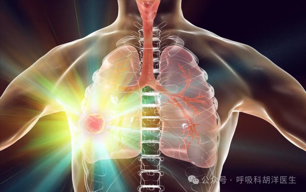 肺部结节诊断与治疗：胸部CT、抗感染治疗及手术选择