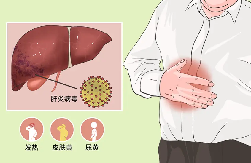 乙肝患者检查频率指南：根据病情和治疗情况定制个性化监测方案