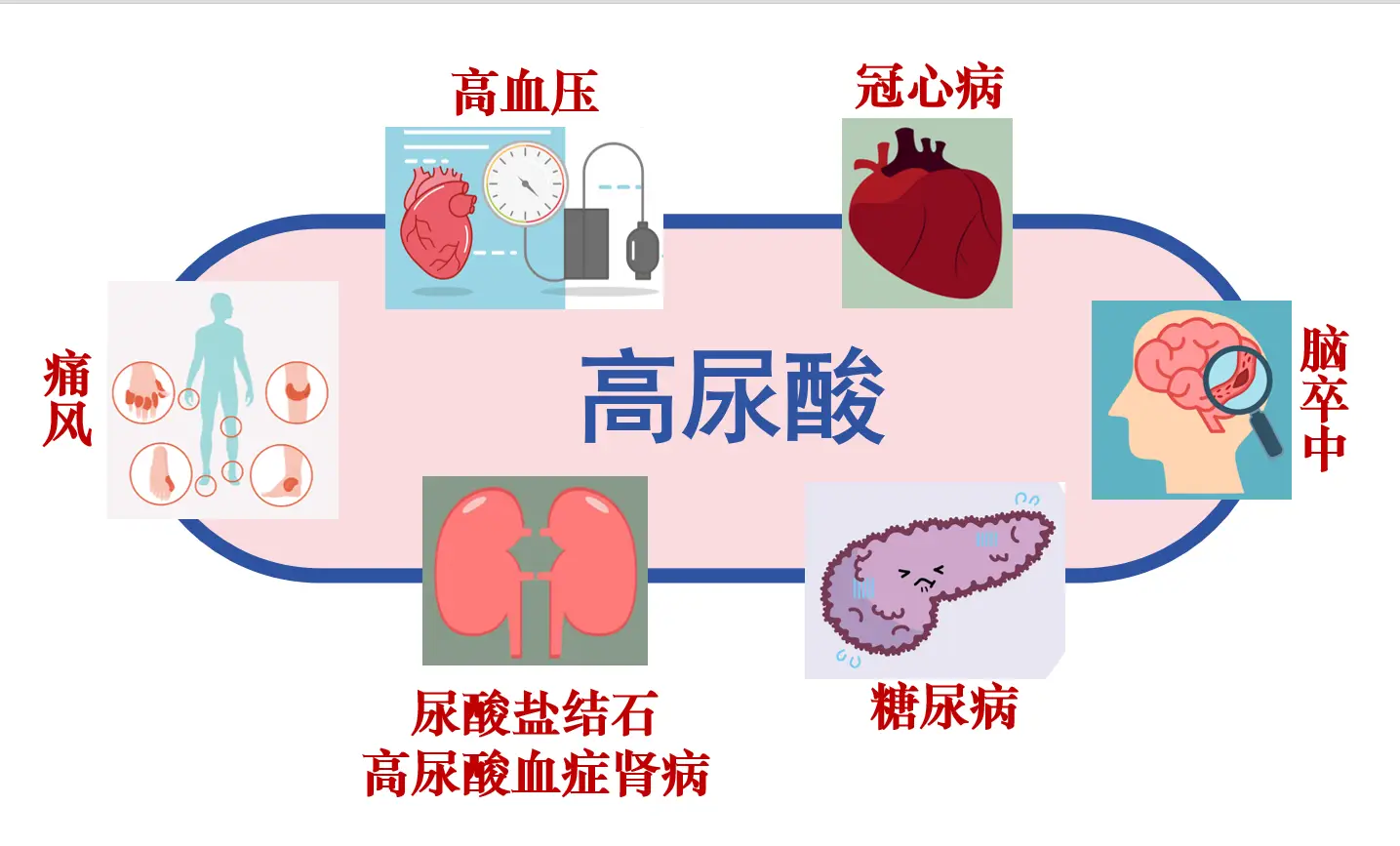 儿童高尿酸血症：原因、表现及预防措施，了解尿酸水平超标的关键  第3张