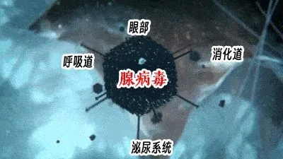 腺病毒感染激增：儿童健康警示与预防措施详解  第4张