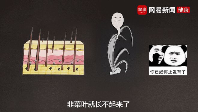 夏天脱毛大作战：永久脱毛大招揭秘，告别磨人毛发困扰  第4张