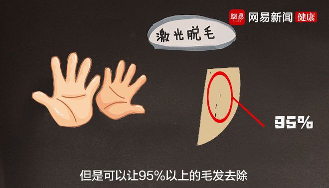 夏天脱毛大作战：永久脱毛大招揭秘，告别磨人毛发困扰  第5张