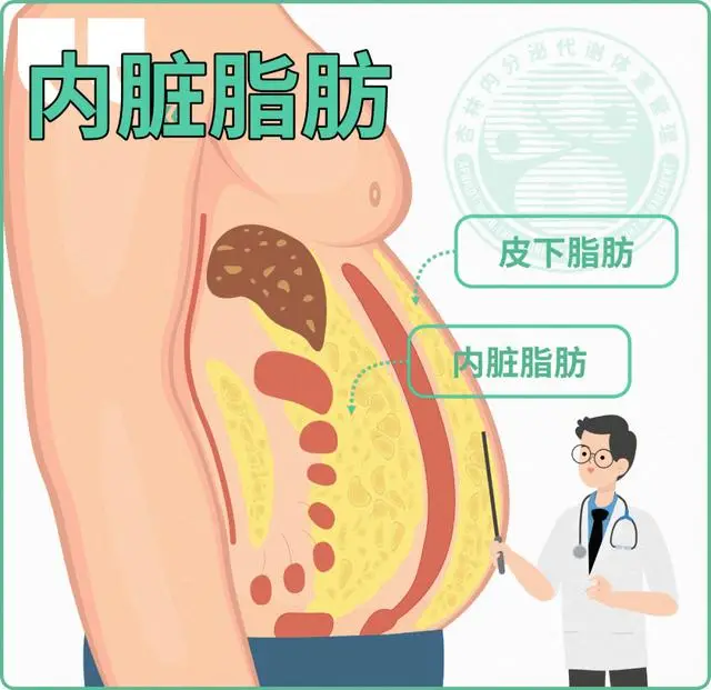 抽脂手术：瘦身奇迹还是美丽陷阱？揭秘抽脂背后的风险与真相  第2张