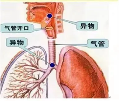 北京天坛公园男子疑吃驴打滚窒息身亡，热心群众紧急施救  第4张