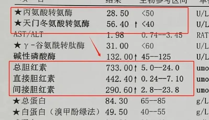 深入了解肝功能检查中的关键指标：转氨酶、胆红素和白蛋白  第2张